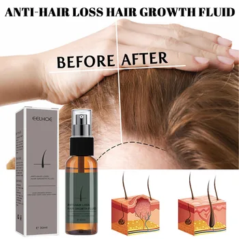 30ml milagre cuidados do cabelo, óleo essencial de condicionador de gengibre crescimento do cabelo, óleo essencial de Marrocos Nutre o cabelo de Cabeleireiro