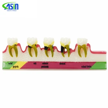 Dental, Doença Periodontal, classificar Dentes Dentoform Typodont Estudo de Modelo de Ensino
