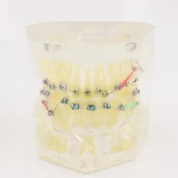 Dental Modelo Transparente Ortodontia Modelo De Tratamento De Dentes Estudo/Ensinar Modelo