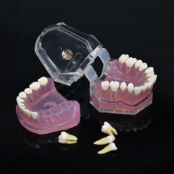 Dentista Macio Modelo de Fundação permitir retirar Dente Sugar puxe modelo de Ensino Dente Dentárias Removíveis Modelos