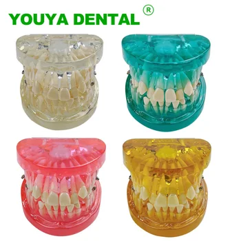 Dentário Ortodôntico Modelo Transparente Dentes De Oclusão Modelo Para A Comunicação Do Paciente Odontologia Dentista De Ensino Do Estudo Do Modelo